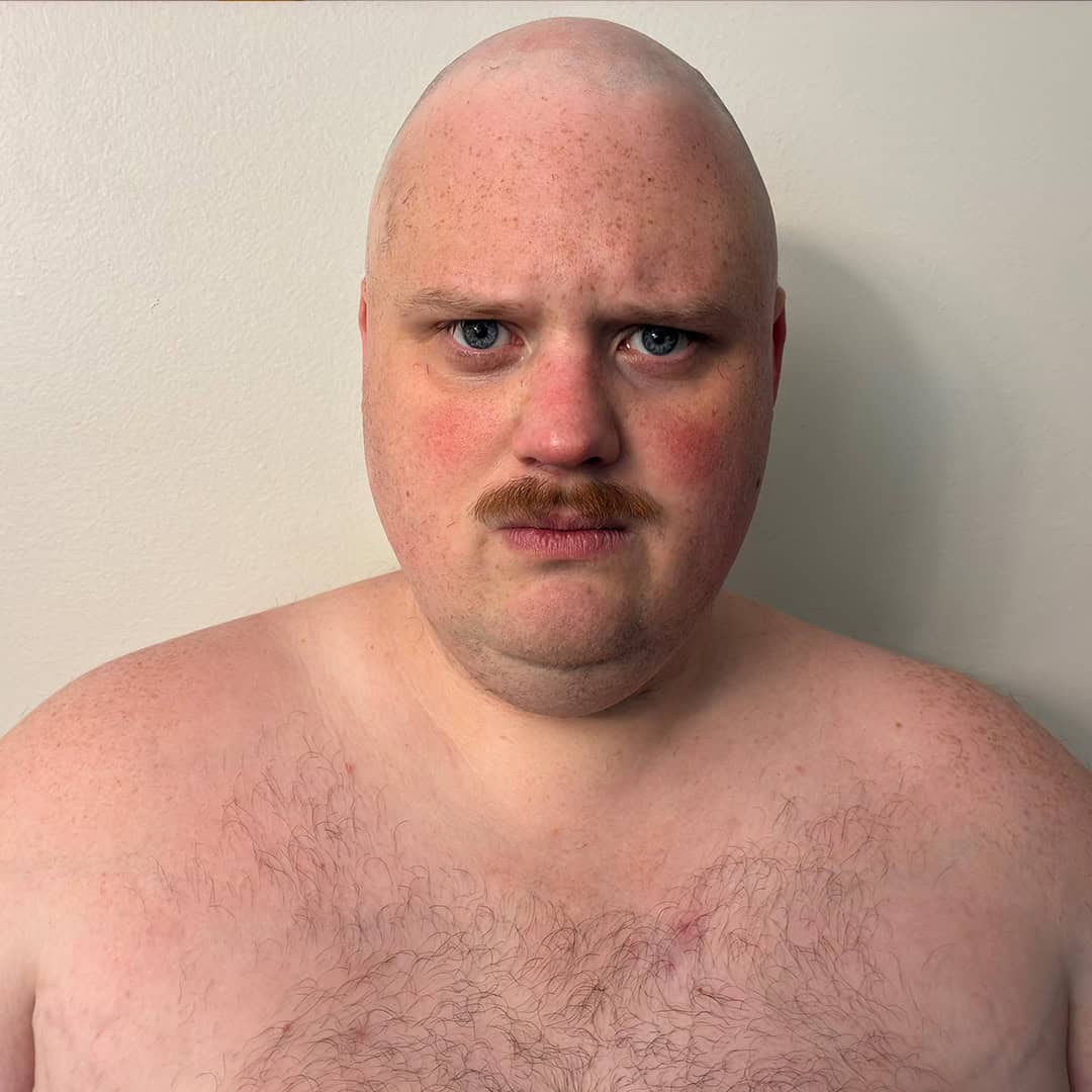 Man with a mustache and bald head looking at the camera.