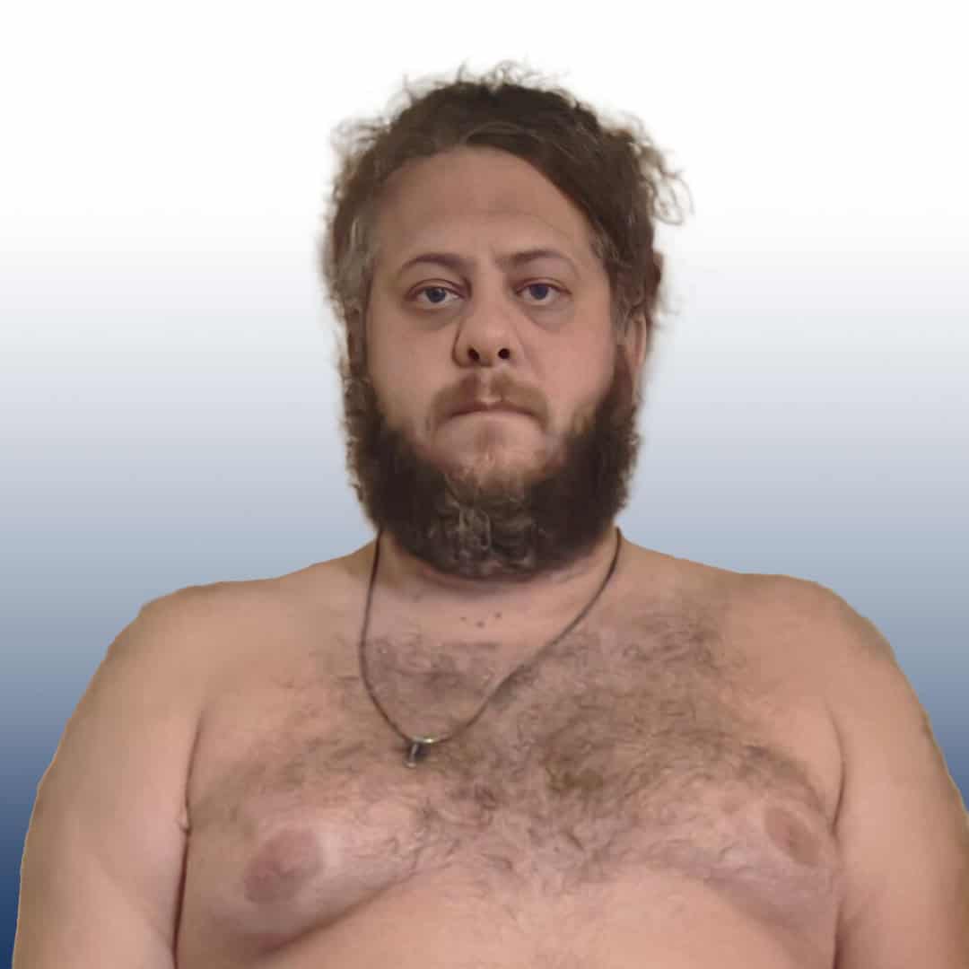Sumo wrestler with beard and chest hair, looking serious.