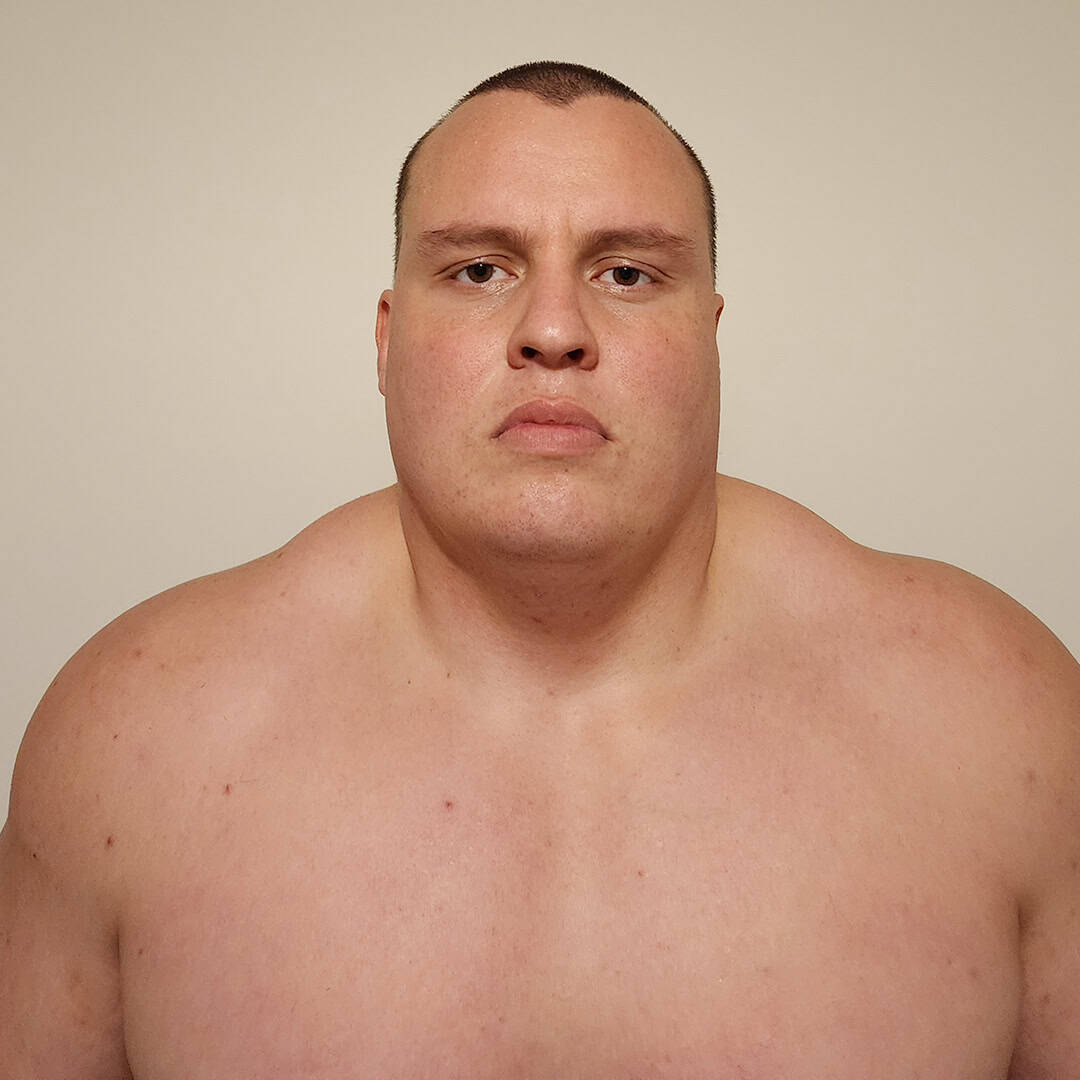 Close-up of a sumo wrestler's face and shoulders.